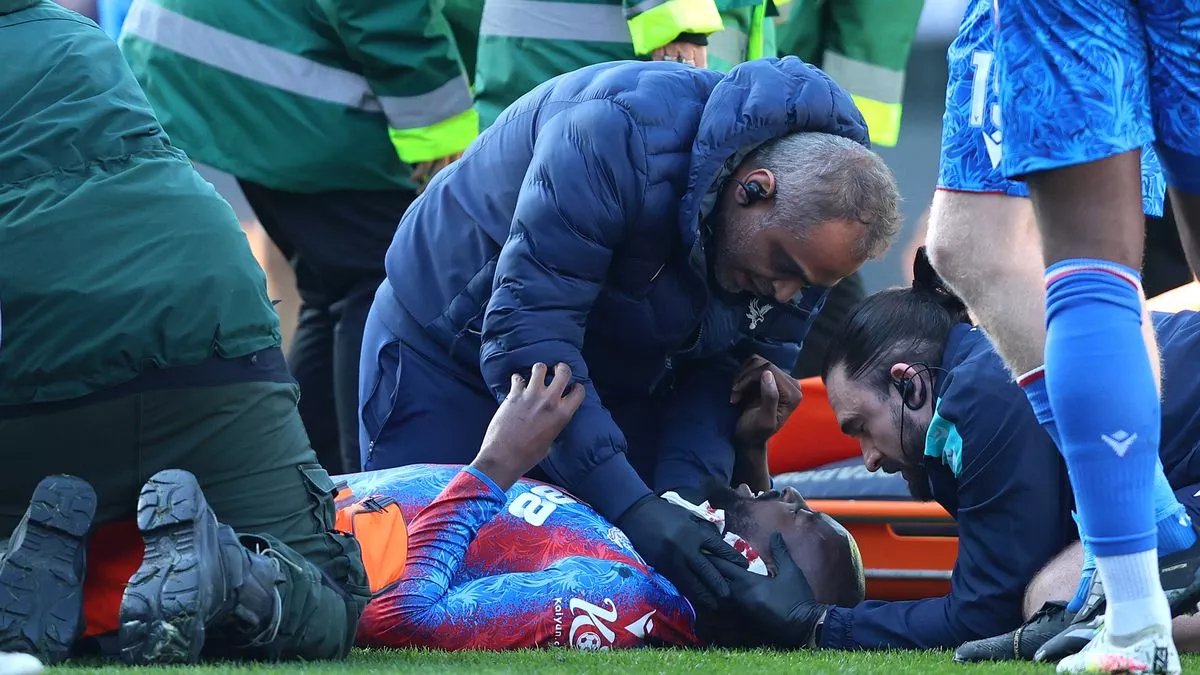 Crystal Palace release Jean-Philippe Mateta update after horror FA Cup injury