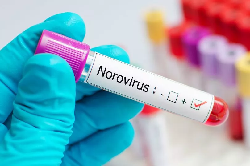 Scientists reveal the exact reason why a norovirus doesn't have a vaccine yet