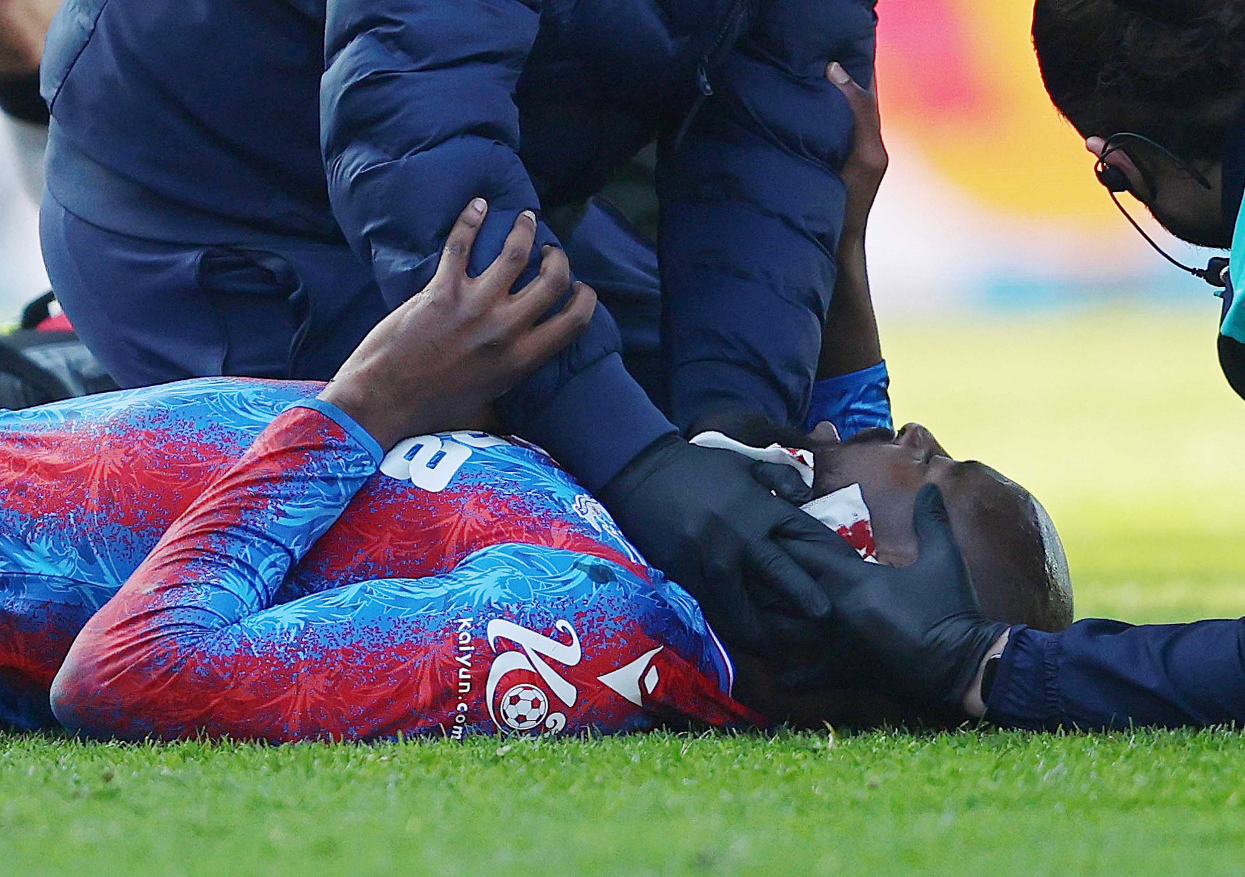 Crystal Palace release Jean-Philippe Mateta injury statement as star leaves hospital after ‘severe l...