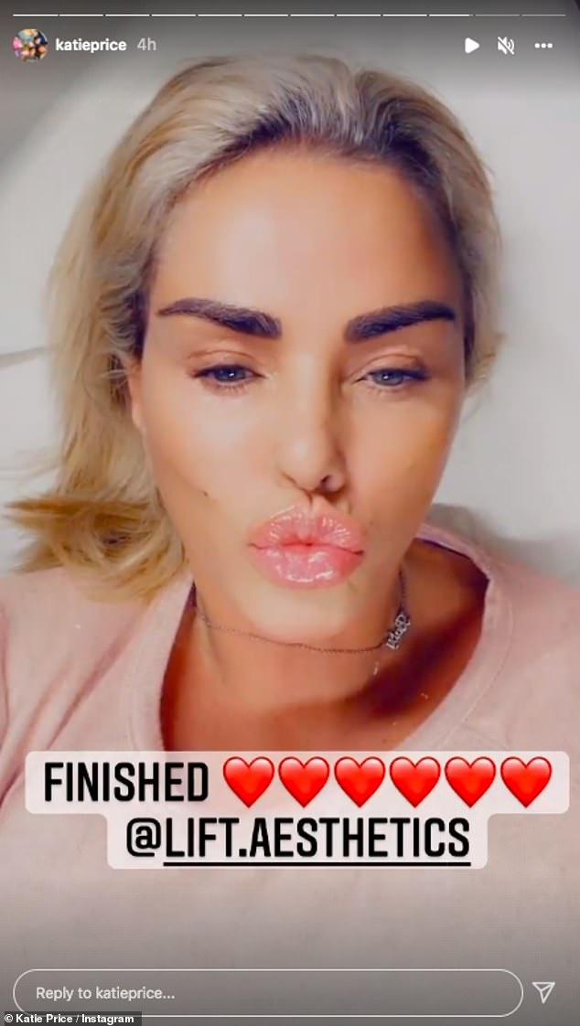 Katie Price shows off her plump pout after getting lip filler